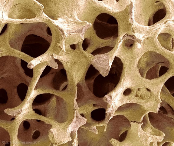 bone-structure
