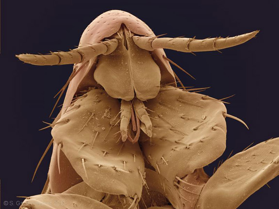human-flea